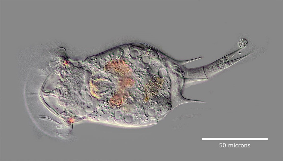 Squatinella rostrum в дифференциальной интерференционно-контрастной микроскопии